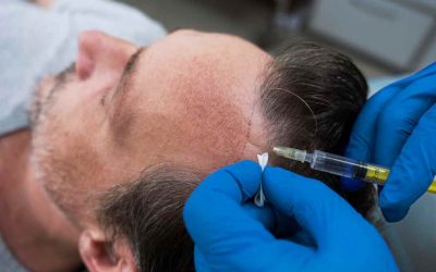 The Definitive Guide for PRPRx for Hair Restoration in Houston
