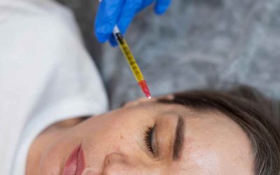 The Synergy of Microneedling and PRPRx for Skin Rejuvenation