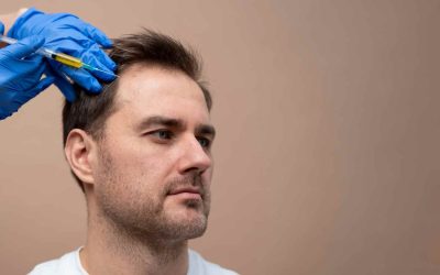 PRPRx for Hair Loss: Guide to the Procedure in Houston
